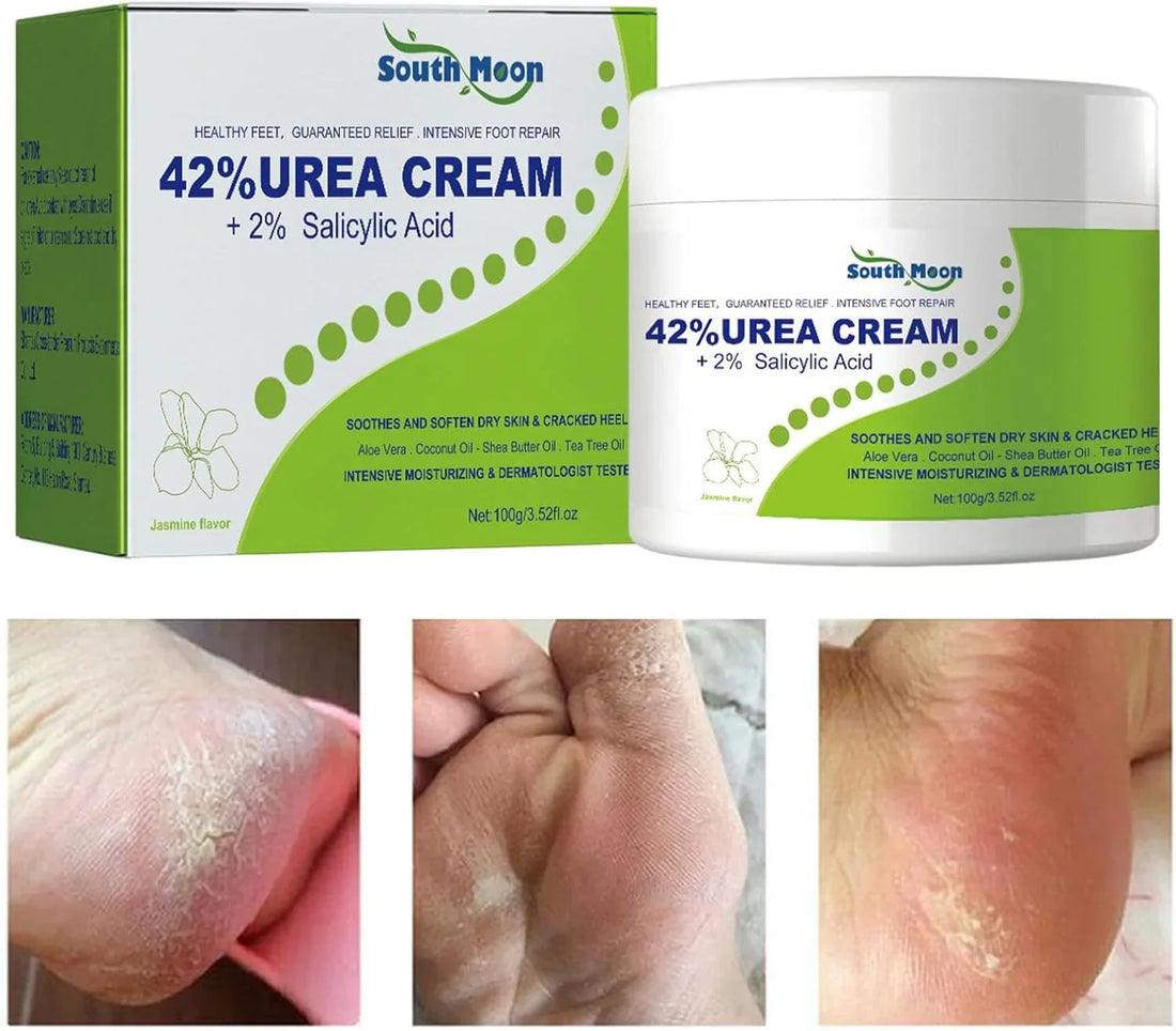 South Moon Urea Cream with 2% Salicylic Acid, creamy texture in a jar, designed for skin moisturizing and exfoliation.